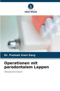 Operationen mit parodontalem Lappen
