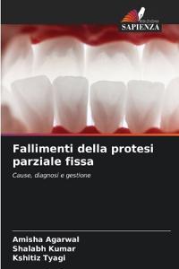 Fallimenti della protesi parziale fissa