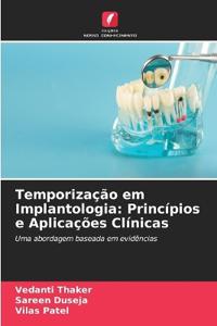 Temporização em Implantologia