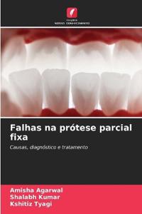 Falhas na prótese parcial fixa