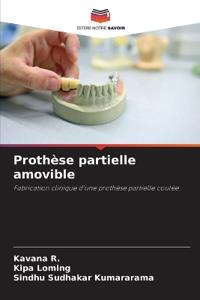 Prothèse partielle amovible