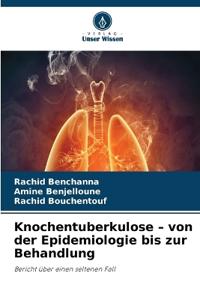 Knochentuberkulose - von der Epidemiologie bis zur Behandlung