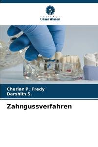 Zahngussverfahren