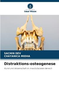 Distraktions-osteogenese