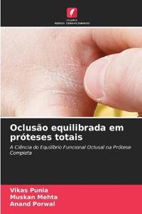 Oclusão equilibrada em próteses totais