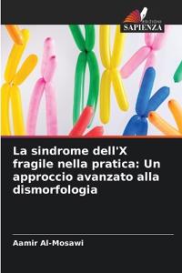 La sindrome dell'X fragile nella pratica