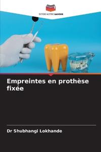 Empreintes en prothèse fixée