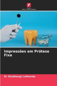 Impressões em Prótese Fixa