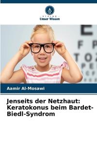 Jenseits der Netzhaut: Keratokonus beim Bardet-Biedl-Syndrom