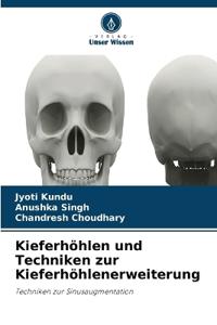 Kieferhöhlen und Techniken zur Kieferhöhlenerweiterung
