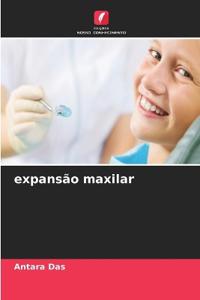 expansão maxilar