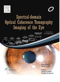 Spectral-domain Optical Coherence Tomography Imaging of the Eye