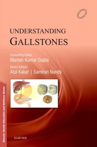 Understanding Gallstones - E-Book