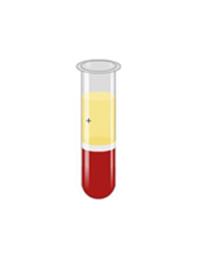 Packed Cell Volume (PCV)