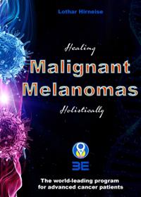 Malignant Melanomas
