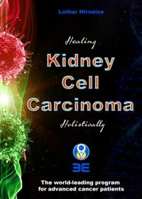 Kidney Cell Carcinoma