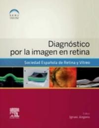 Diagnóstico por la imagen en retina