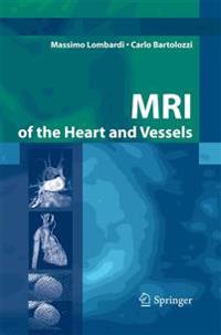 Bokomslag för "MRI of the Heart and Vessels"
