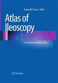 Atlas of Ileoscopy