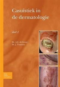 Casuïstiek in de Dermatologie - Deel I