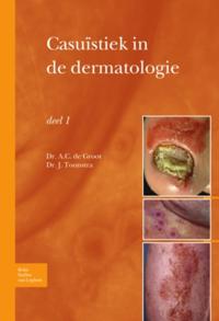 Casuïstiek in de dermatologie - deel I
