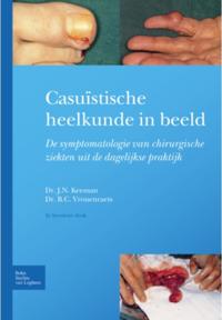 Dutch language eBook collection
