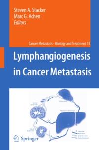 Cancer Metastasis - Biology and Treatment