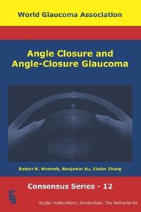 Angle Closure and Angle-Closure Glaucoma