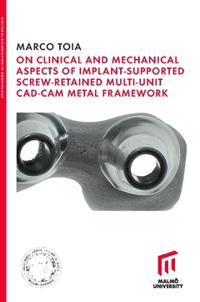On Clinical and Mechanical Aspects of Implant-Supported Screw-Retained Multi-Unit CAD-CAM Metal Framework