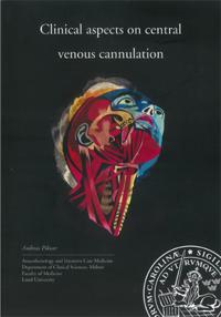Clinical aspects on central venous cannulation
