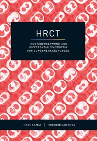 HRCT : mustererkennung und Differentialdiagnostik von Lungenerkrankungen