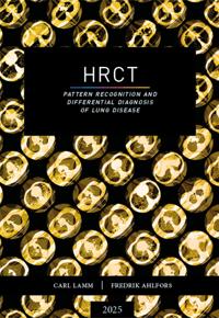 HRCT – pattern recognition and differential diagnosis of lung disease