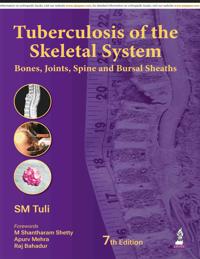 Tuberculosis of the Skeletal System
