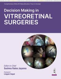 Decision Making in Vitreoretinal Surgeries
