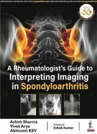 A Rheumatologist's Guide to Interpreting Imaging in Spondyloarthritis