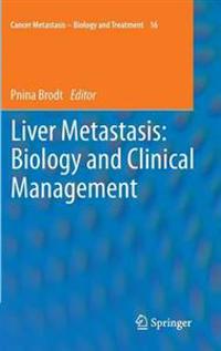 Liver Metastasis: Biology and Clinical Management