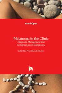 Melanoma in the Clinic