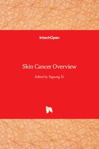 Skin Cancer Overview