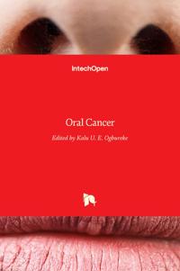 Oral Cancer