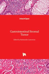 Gastrointestinal Stromal Tumor