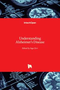 Understanding Alzheimer's Disease