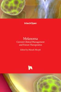 Melanoma