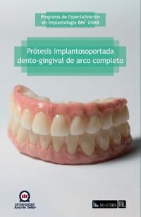 Prótesis implantosoportada dento-gingival de arco completo