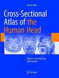 Cross-Sectional Atlas of the Human Head
