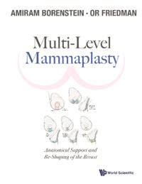 Multi-level Mammaplasty: Anatomical Support And Re-shaping Of The Breast