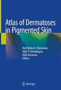 Bokomslag for "Atlas of Dermatoses in Pigmented Skin"