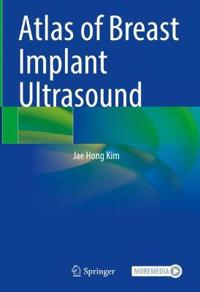 Bokomslag for "Atlas of Breast Implant Ultrasound"