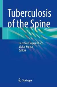 Tuberculosis of the Spine