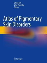 Bokomslag for "Atlas of Pigmentary Skin Disorders"