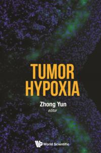 Tumor Hypoxia